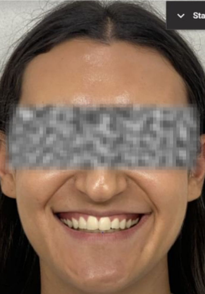 Example Image